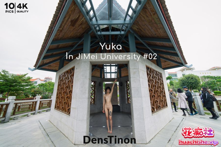 北京天使DensTinon