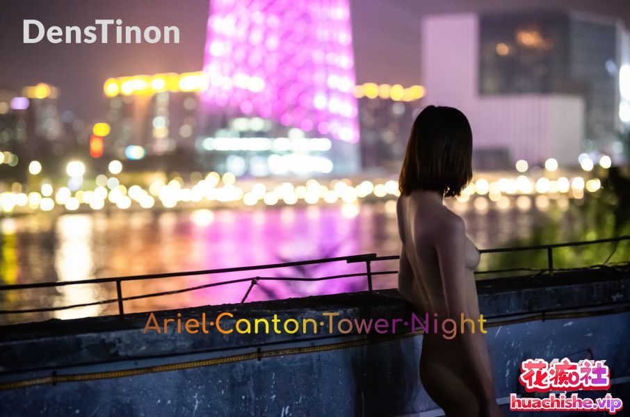 北京天使DensTinon